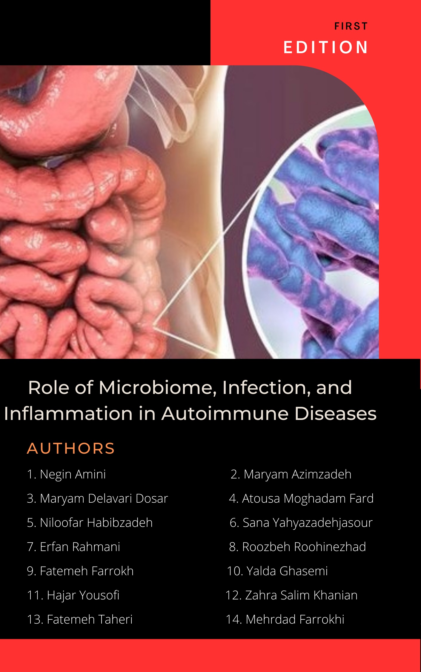 Role of Microbiome, Infection, and Inflammation in Autoimmune Diseases